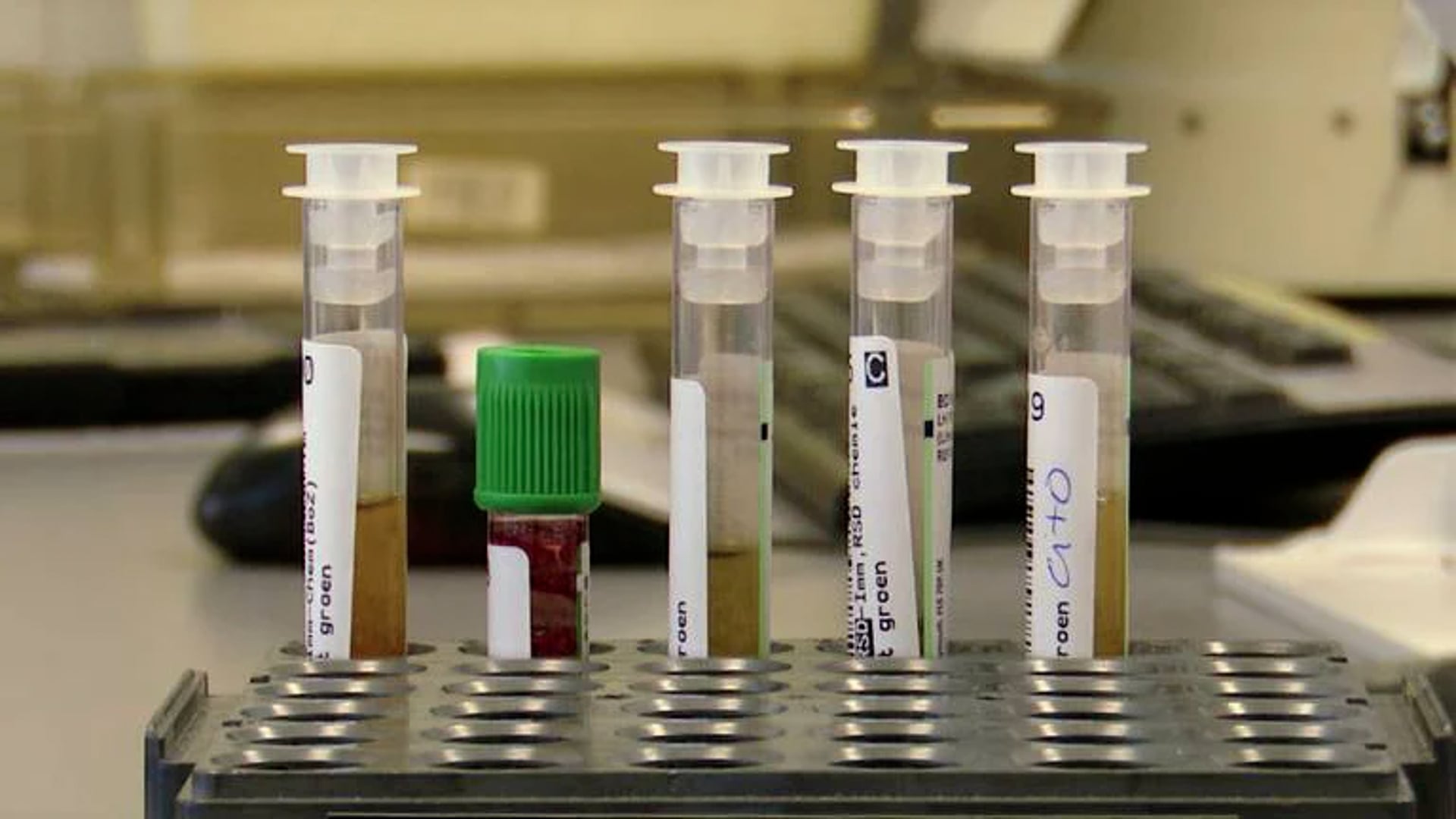 Bravis raakt buisjes bloed en potjes weefsel nu nooit meer kwijt - VIDEO